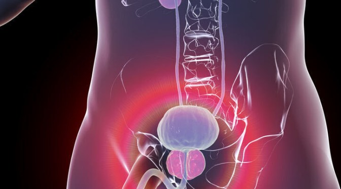 Santé : Cancer de la prostate, les signes qui doivent alerter