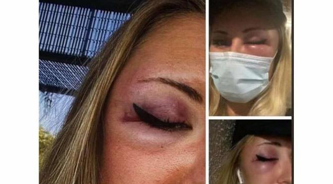 Strasbourg : Une jeune fille agressée en pleine rue parce qu&rsquo;elle portait une jupe !