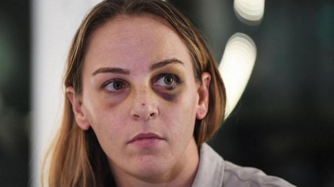 Margaux Pinot ne comprends pas la relaxe de son compagnon qui l&rsquo;a sauvagement tabassé.