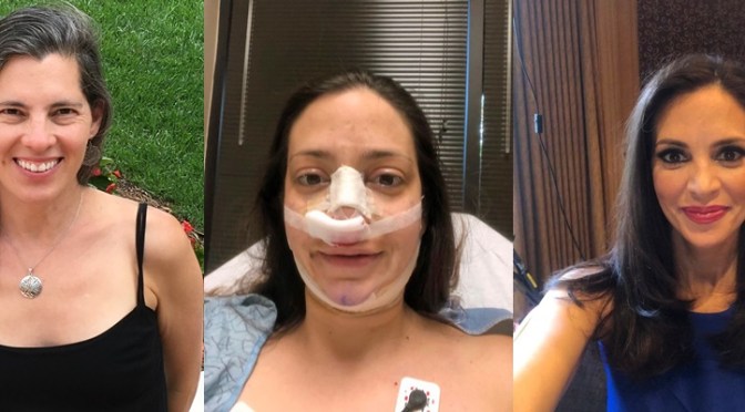 Une américaine dépense 30.000 dollars en chirurgie esthétique pour ressembler à la Duchesse Meghan Markle !