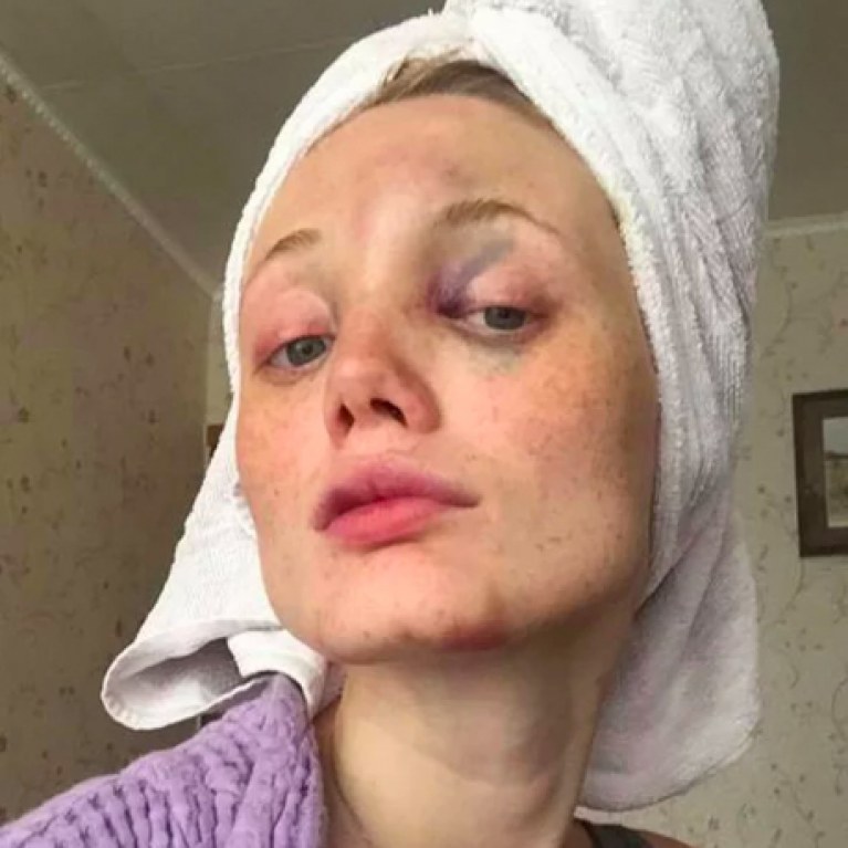 une-victime-de-violences-conjugales-1317886_w767h767c1cx228cy297