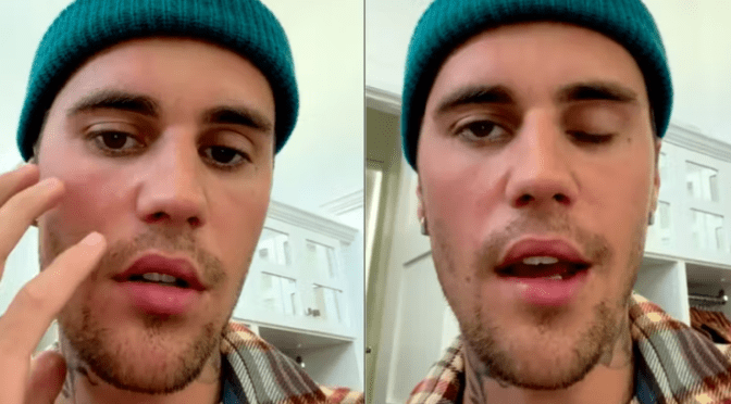Justin Bieber, atteint d’une paralysie du visage, annule le reste de sa tournée mondiale!